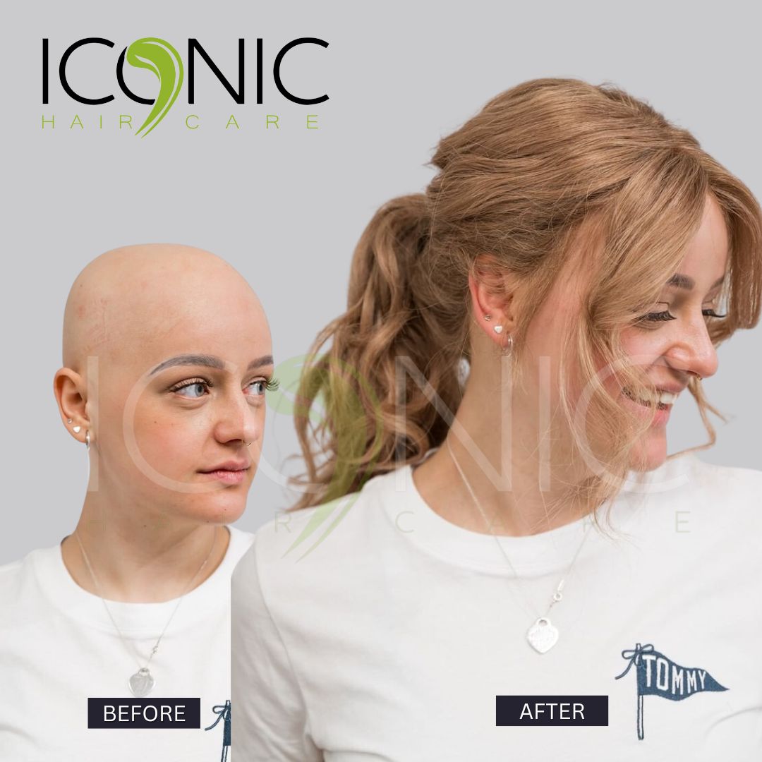 Iconic Hair Fixing Center